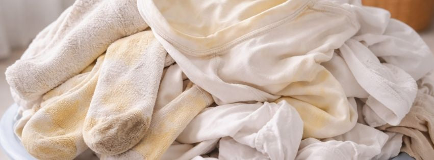 Roupa branca amarelada: como recuperar o branco sem estragar o tecido